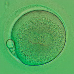 fertilized-egg