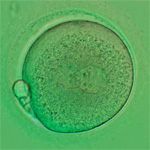 fertilized egg